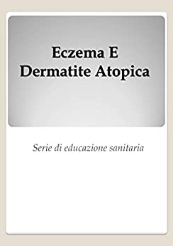 Eczema E Dermatite Atopica