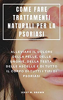 COME FARE TRATTAMENTI NATURALI PER LA PSORIASI : ALLEVIARE IL DOLORE DELLA PELLE, DELLE UNGHIE, DELLA TESTA, DELLE ASCELLE E DI TUTTO IL CORPO DI TUTTI I TIPI DI PSORIASI