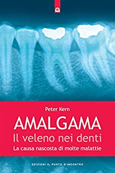 Amalgama: il veleno nei denti: La causa nascosta di molte malattie